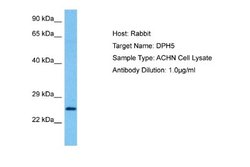 DPH5 Antibody, Novus Biologicals 100 &mu;L; Unconjugated:Antibodies, Polyclonal